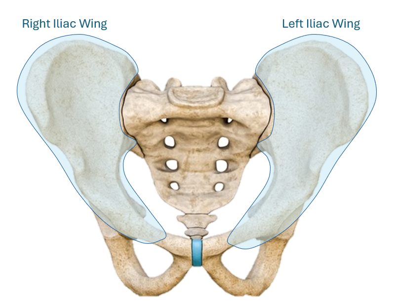 Iliac Wing